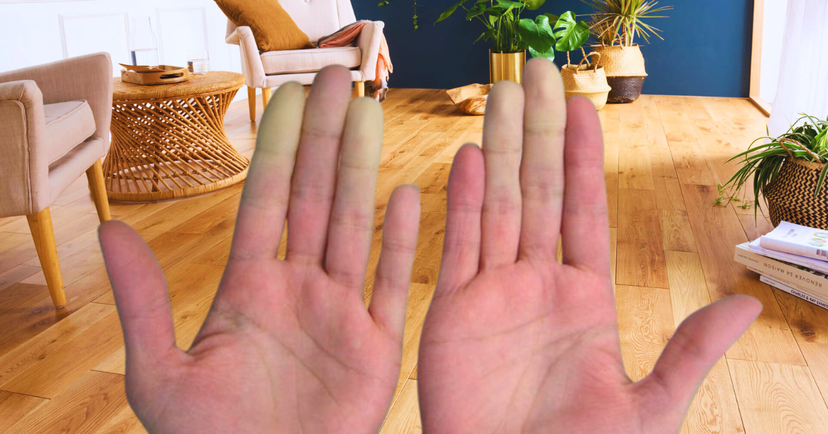 Vos doigts deviennent blancs : les symptômes du syndrome de Raynaud qui doivent vous alarmer