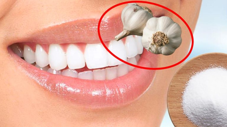 L’astuce étonnante pour blanchir vos dents avec du sel et de l’ail : un duo qui transforme les sourires