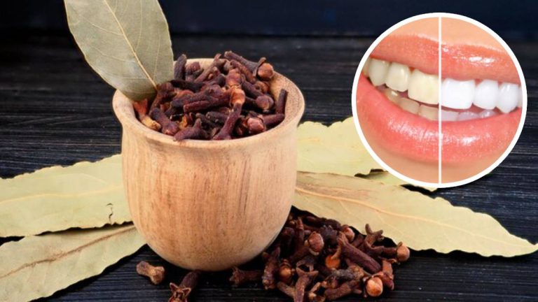 Faites ceci avec du laurier et des clous de girofle pour des dents blanches naturellement