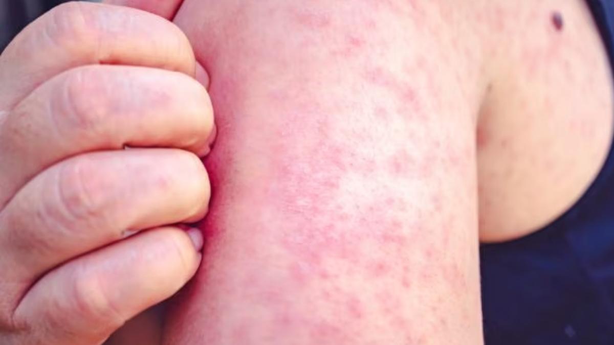 Votre bras gratte ? Prenez ce signal très au sérieux, il peut révéler un véritable problème de santé